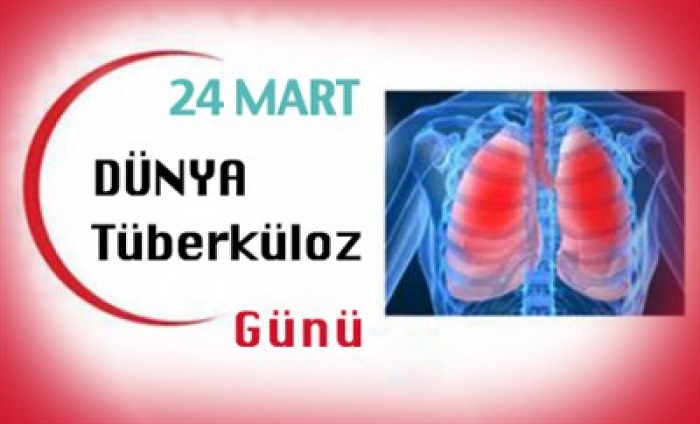 24 MART DÜNYA TÜBERKÜLOZ GÜNÜ BASIN BİLDİRİSİ